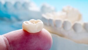 Dental Crown procedures in Novi Michigan