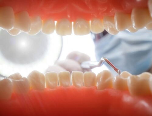 The Evolution of Tooth Fillings: From Amalgam to Modern Materials
