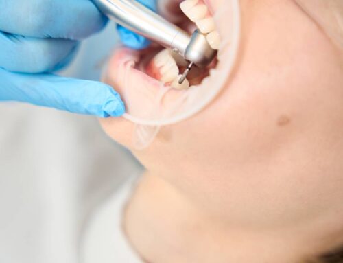 The Longevity Puzzle: How Long Do Dental Crowns Really Last?