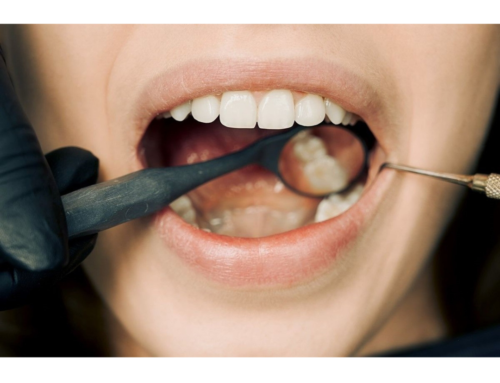 What Dental Procedures Are Non-Cosmetic?